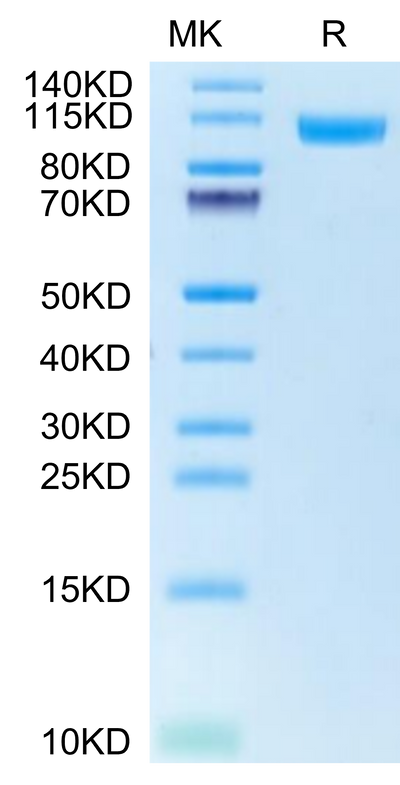 Human NCAM-1 on Tris-Bis PAGE under reduced condition. The purity is greater than 95%.Recombinant Human NCAM-1/CD56 Protein, Active