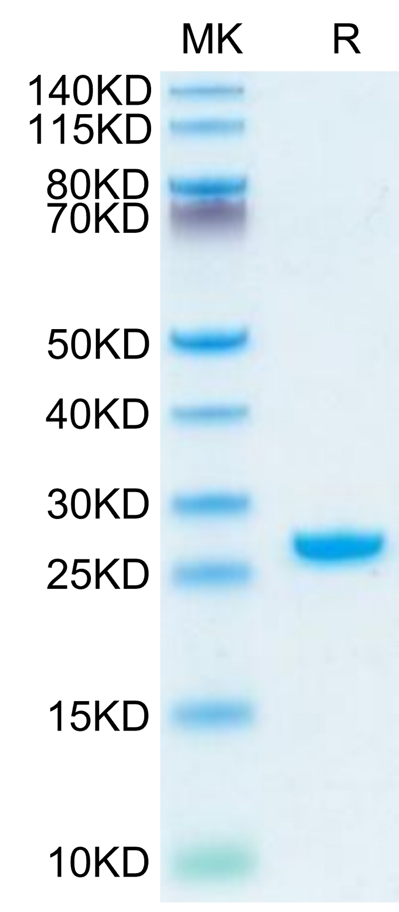 Rhesus macaque Complement Factor D on Tris-Bis PAGE under reduced condition. The purity is greater than 95%.Recombinant Rhesus macaque Complement Factor D/CFD Protein, Active