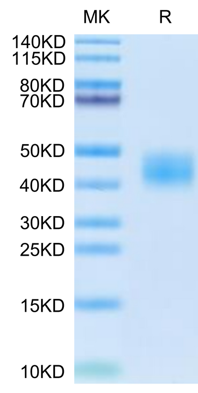 Cynomolgus CA12 on Tris-Bis PAGE under reduced condition. The purity is greater than 95%.Recombinant Cynomolgus CA12/Carbonic anhydrase XII Protein