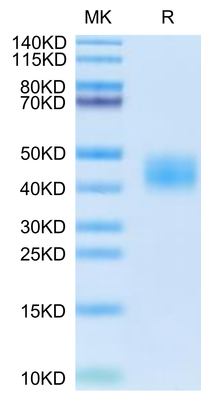 Cynomolgus CA12 on Tris-Bis PAGE under reduced condition. The purity is greater than 95%.Recombinant Cynomolgus CA12/Carbonic anhydrase XII Protein