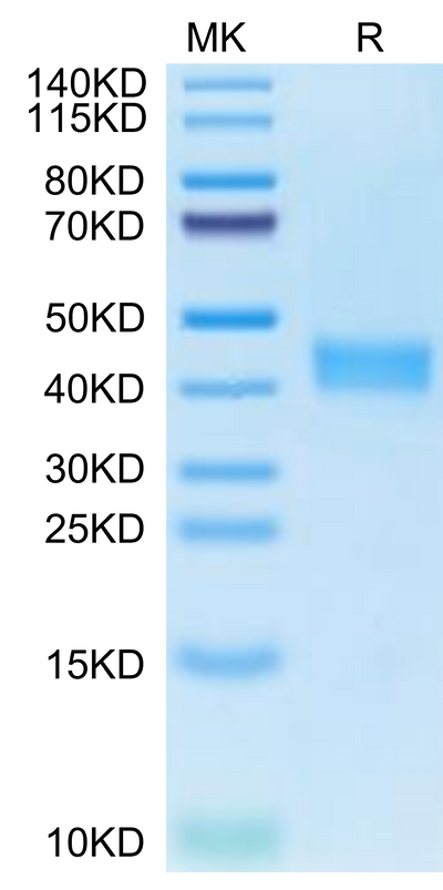Human CA12 on Tris-Bis PAGE under reduced condition. The purity is greater than 95%.Recombinant Human CA12/Carbonic anhydrase XII Protein