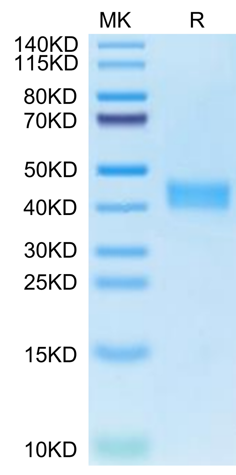 Human CA12 on Tris-Bis PAGE under reduced condition. The purity is greater than 95%.Recombinant Human CA12/Carbonic anhydrase XII Protein