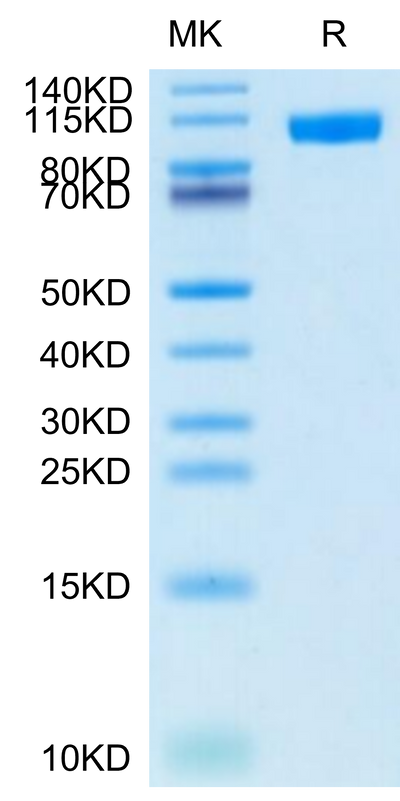 Cynomolgus NCAM-1 on Tris-Bis PAGE under reduced condition. The purity is greater than 95%.Recombinant Cynomolgus NCAM-1/CD56 Protein, Active