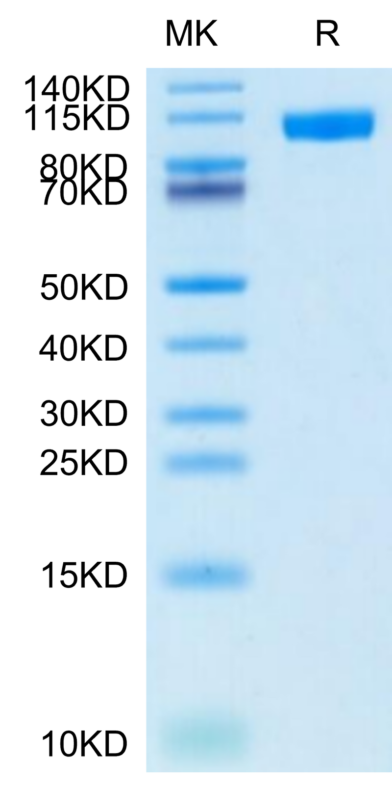 Cynomolgus NCAM-1 on Tris-Bis PAGE under reduced condition. The purity is greater than 95%.Recombinant Cynomolgus NCAM-1/CD56 Protein, Active