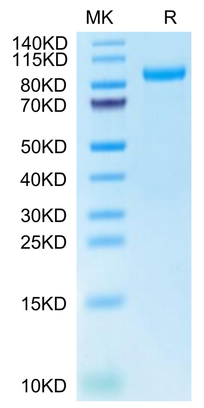 Cynomolgus HGFA (pro form) on Tris-Bis PAGE under reduced condition. The purity is greater than 95%.Recombinant Cynomolgus HGFA Protein (pro form)