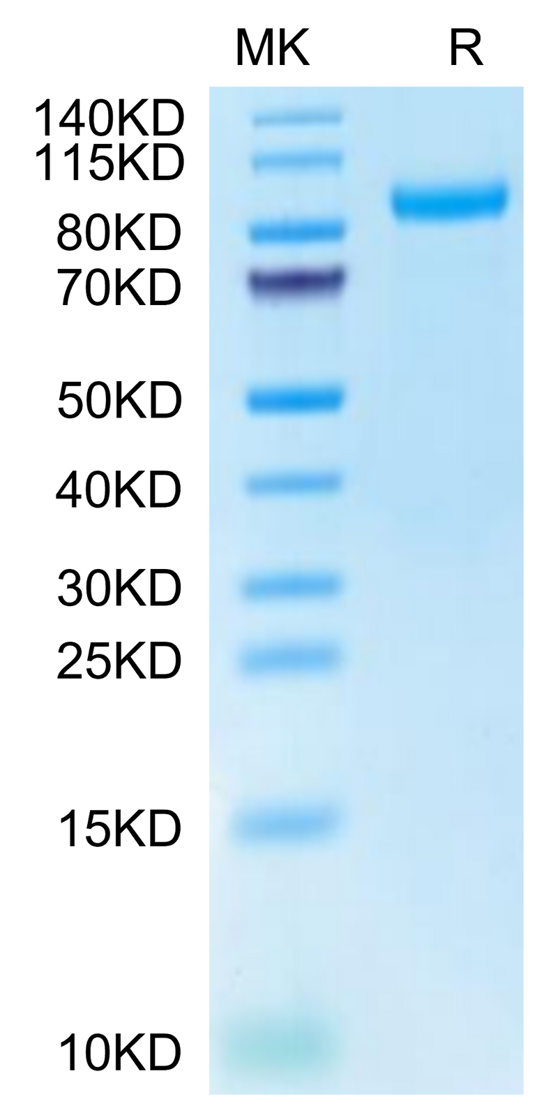 Cynomolgus HGFA (pro form) on Tris-Bis PAGE under reduced condition. The purity is greater than 95%.Recombinant Cynomolgus HGFA Protein (pro form)