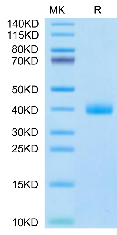 Cynomolgus IL-22R alpha 1 on Tris-Bis PAGE under reduced condition. The purity is greater than 95%.Recombinant Cynomolgus IL-22R alpha 1 Protein, Active