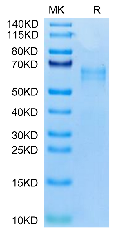 Human LTK on Tris-Bis PAGE under reduced condition. The purity is greater than 95%.Recombinant Human LTK Potein