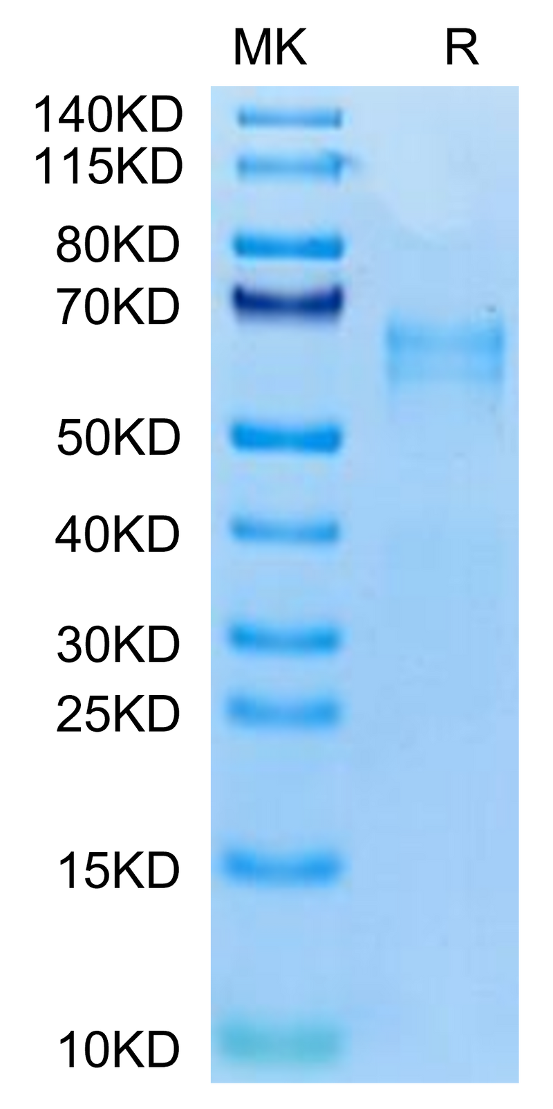 Human LTK on Tris-Bis PAGE under reduced condition. The purity is greater than 95%.Recombinant Human LTK Potein