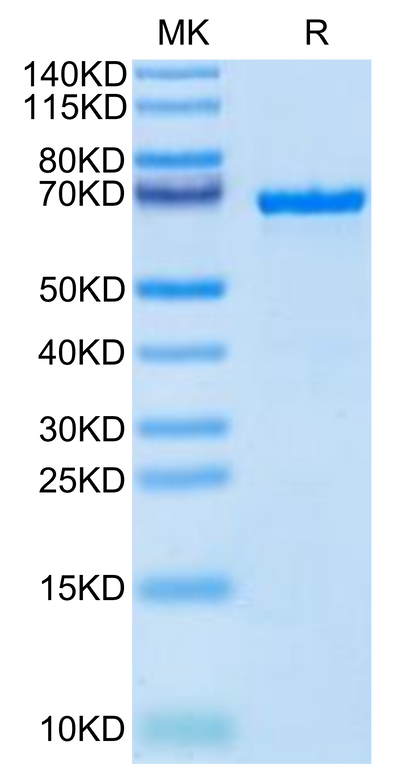 Cynomolgus AFP on Tris-Bis PAGE under reduced condition. The purity is greater than 95%.Recombinant Cynomolgus AFP Protein