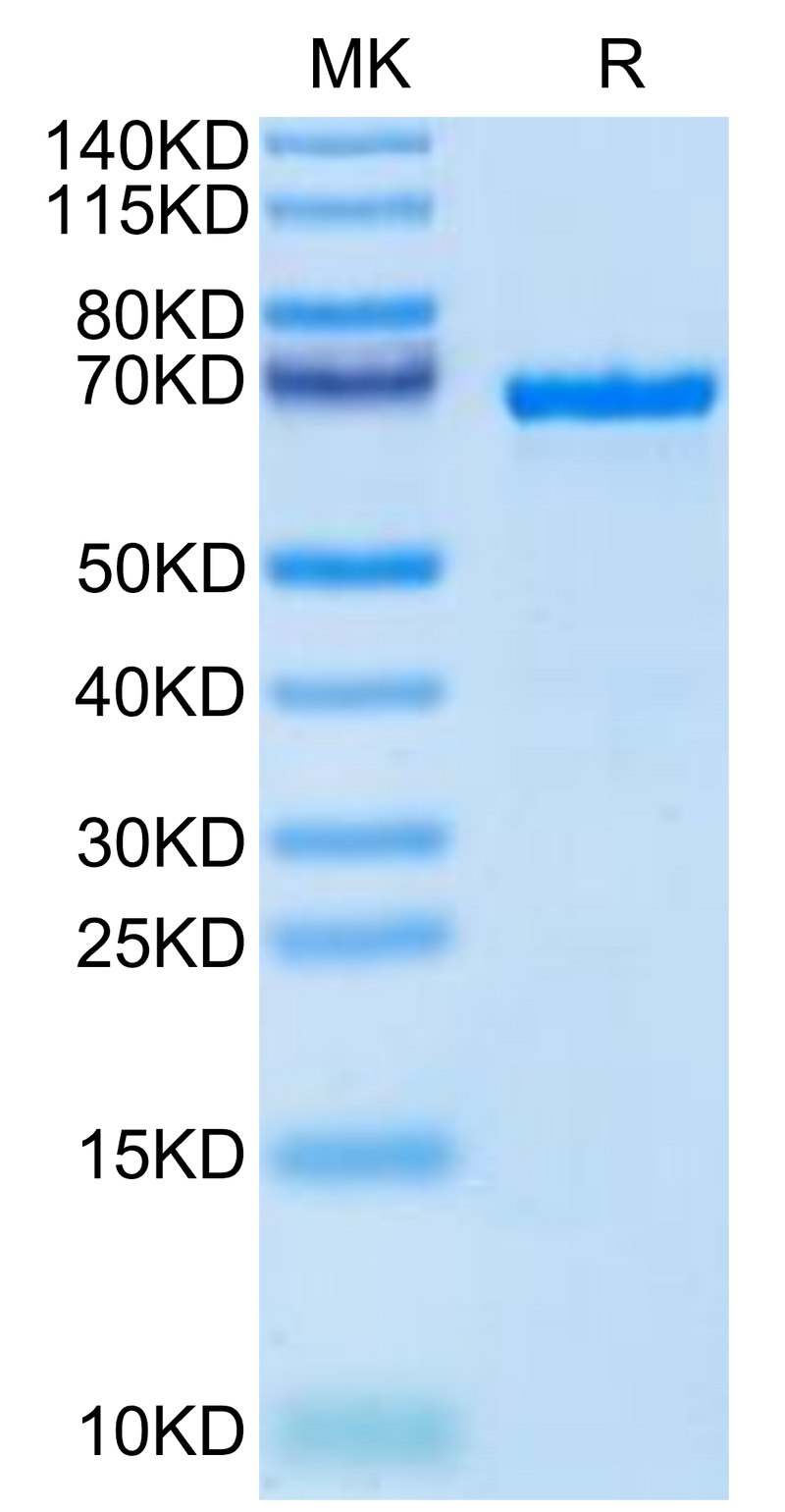 Cynomolgus AFP on Tris-Bis PAGE under reduced condition. The purity is greater than 95%.Recombinant Cynomolgus AFP Protein