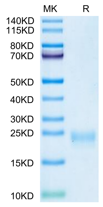 Cynomolgus IL-5 on Tris-Bis PAGE under reduced condition. The purity is greater than 95%.Recombinant Cynomolgus IL-5 Protein, Active