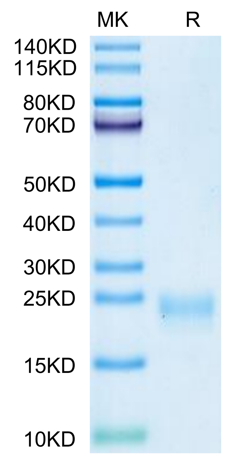 Cynomolgus IL-5 on Tris-Bis PAGE under reduced condition. The purity is greater than 95%.Recombinant Cynomolgus IL-5 Protein, Active