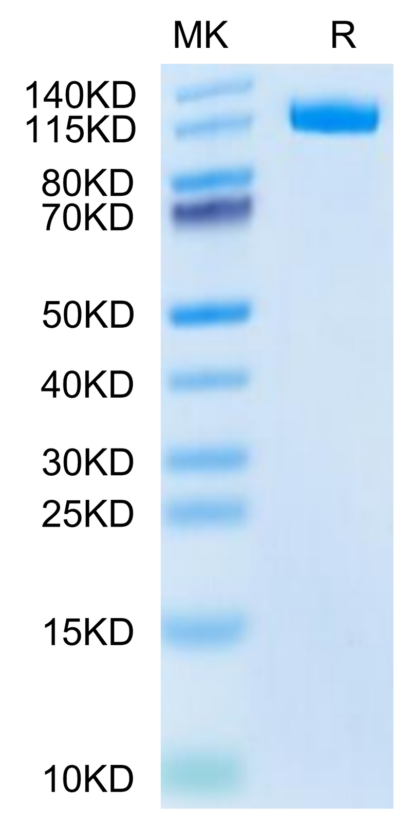 Canine ENPP-3 on Tris-Bis PAGE under reduced condition. The purity is greater than 95%.Recombinant Canine ENPP-3 Protein