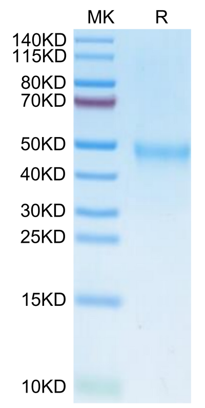 Human IL-21R on Tris-Bis PAGE under reduced condition. The purity is greater than 95%.Recombinant Human IL-21R Protein, Active