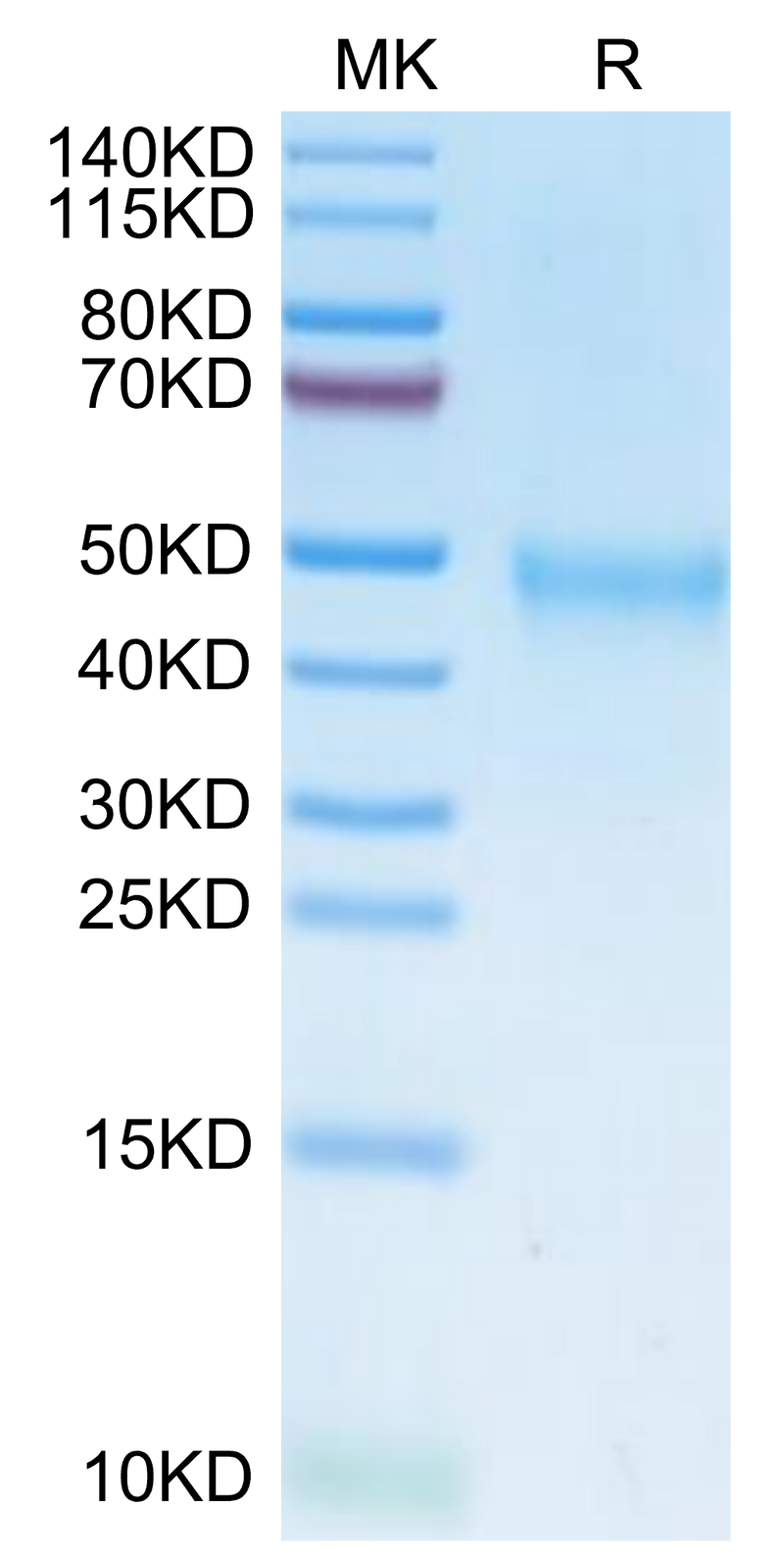 Human IL-21R on Tris-Bis PAGE under reduced condition. The purity is greater than 95%.Recombinant Human IL-21R Protein, Active