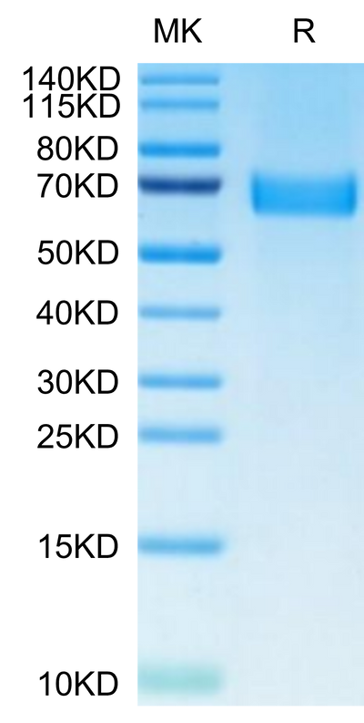 Human AXL on Tris-Bis PAGE under reduced condition. The purity is greater than 95%.Recombinant Human AXL Protein, Active