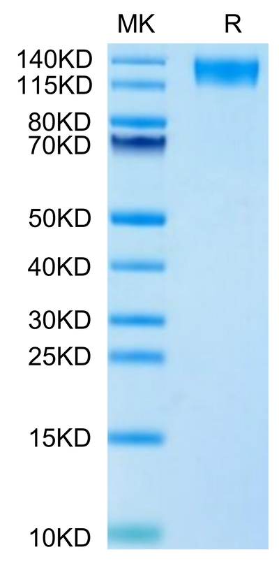 Human LEPR on Tris-Bis PAGE under reduced condition. The purity is greater than 95%.Recombinant Human LEPR Protein