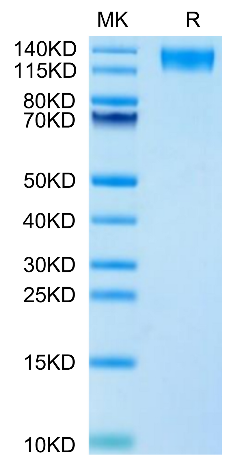 Human LEPR on Tris-Bis PAGE under reduced condition. The purity is greater than 95%.Recombinant Human LEPR Protein