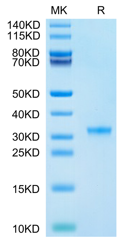 SARS-CoV-2 3CLpro (P132H) on Tris-Bis PAGE under reduced condition. The purity is greater than 95%.Recombinant SARS-CoV-2 3CLpro/3C-like Protease Protein (P132H)