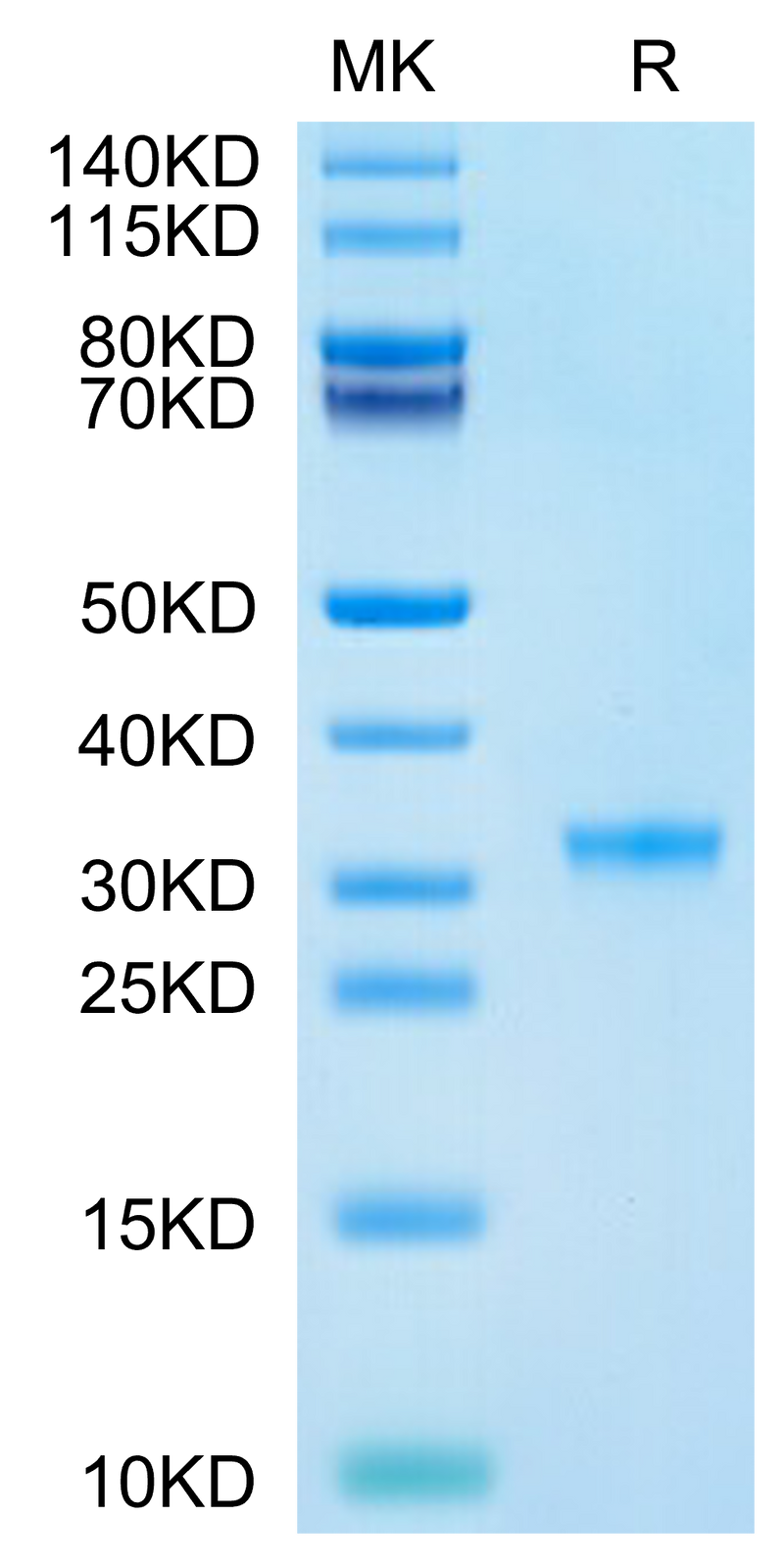 SARS-CoV-2 3CLpro (P132H) on Tris-Bis PAGE under reduced condition. The purity is greater than 95%.Recombinant SARS-CoV-2 3CLpro/3C-like Protease Protein (P132H)