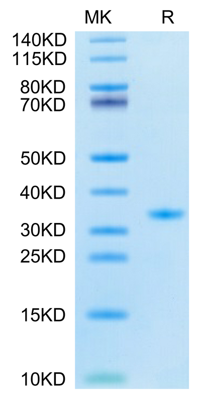 SARS-CoV-2 3CLpro (F140A) on Tris-Bis PAGE under reduced condition. The purity is greater than 95%.Recombinant SARS-CoV-2 3CLpro/3C-like Protease Protein (F140A)