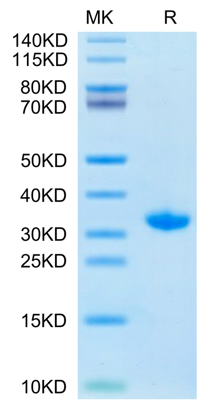 SARS-CoV-2 3CLpro (S144A) on Tris-Bis PAGE under reduced condition. The purity is greater than 95%.Recombinant SARS-CoV-2 3CLpro/3C-like Protease Protein (S144A)