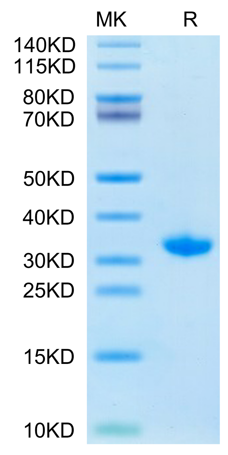 SARS-CoV-2 3CLpro (S144A) on Tris-Bis PAGE under reduced condition. The purity is greater than 95%.Recombinant SARS-CoV-2 3CLpro/3C-like Protease Protein (S144A)