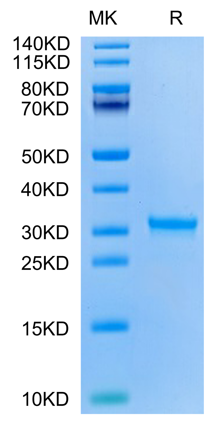 SARS-CoV-2 3CLpro (H172Y) on Tris-Bis PAGE under reduced condition. The purity is greater than 95%.Recombinant SARS-CoV-2 3CLpro/3C-like Protease Protein (H172Y)