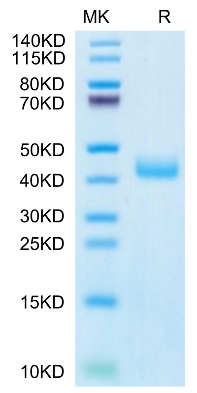 Human CCR8 on Tris-Bis PAGE under reduced condition. The purity is greater than 95%.Recombinant Human CCR8 Protein, Active