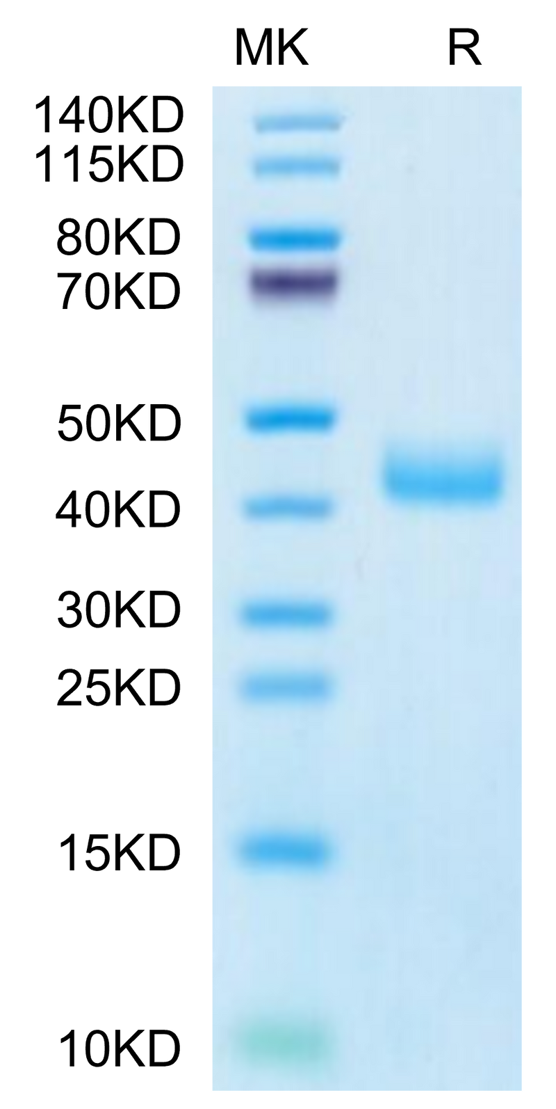 Human CCR8 on Tris-Bis PAGE under reduced condition. The purity is greater than 95%.Recombinant Human CCR8 Protein, Active