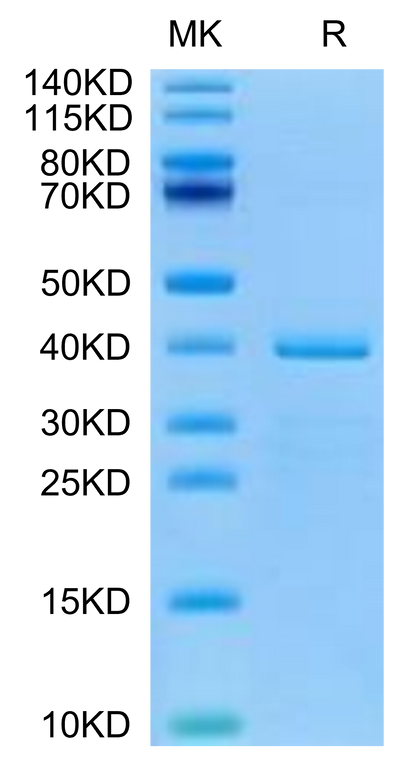 Human HTRA1 on Tris-Bis PAGE under reduced condition. The purity is greater than 95%.Recombinant Human HTRA1 Protein