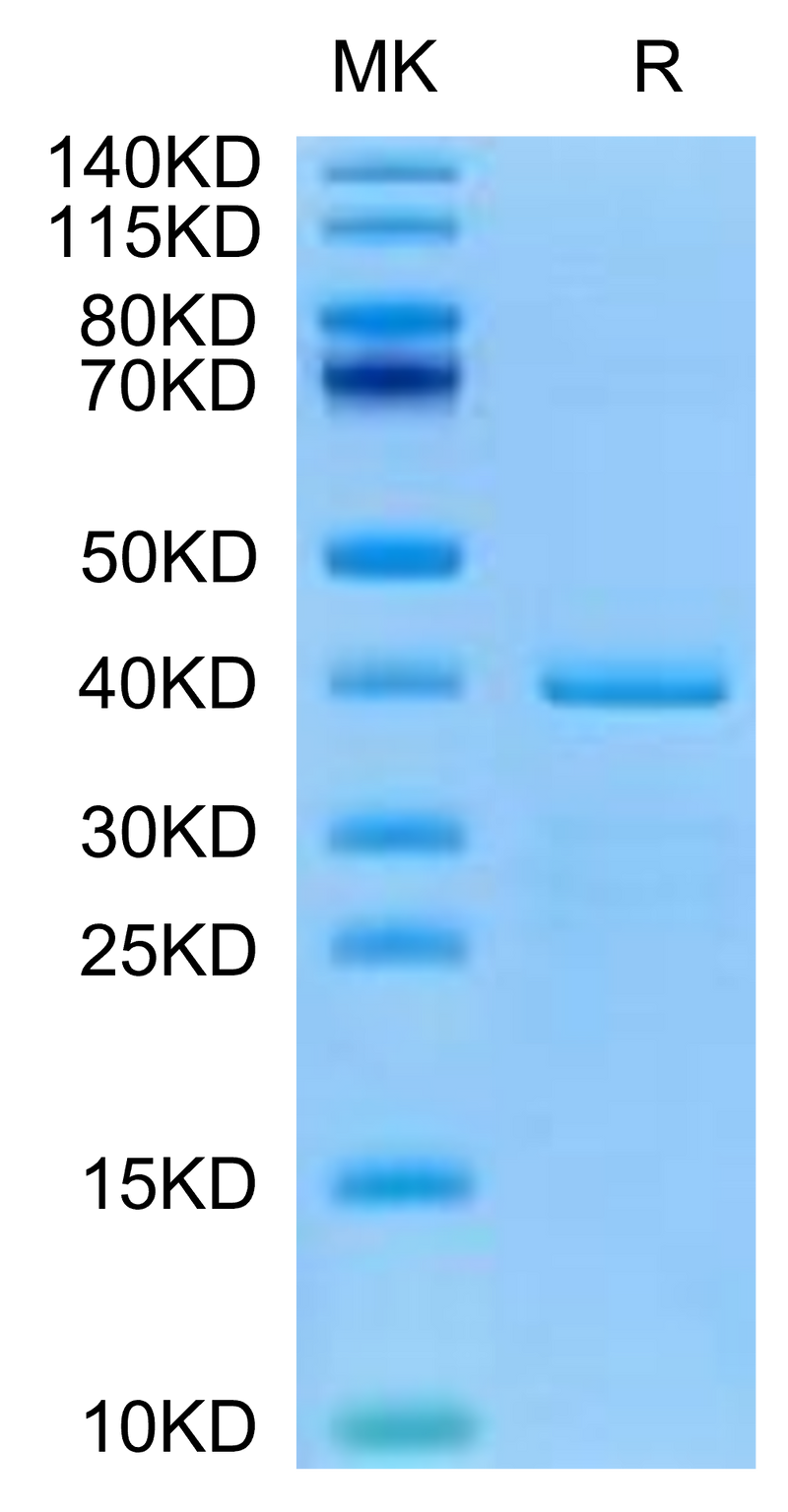 Human HTRA1 on Tris-Bis PAGE under reduced condition. The purity is greater than 95%.Recombinant Human HTRA1 Protein
