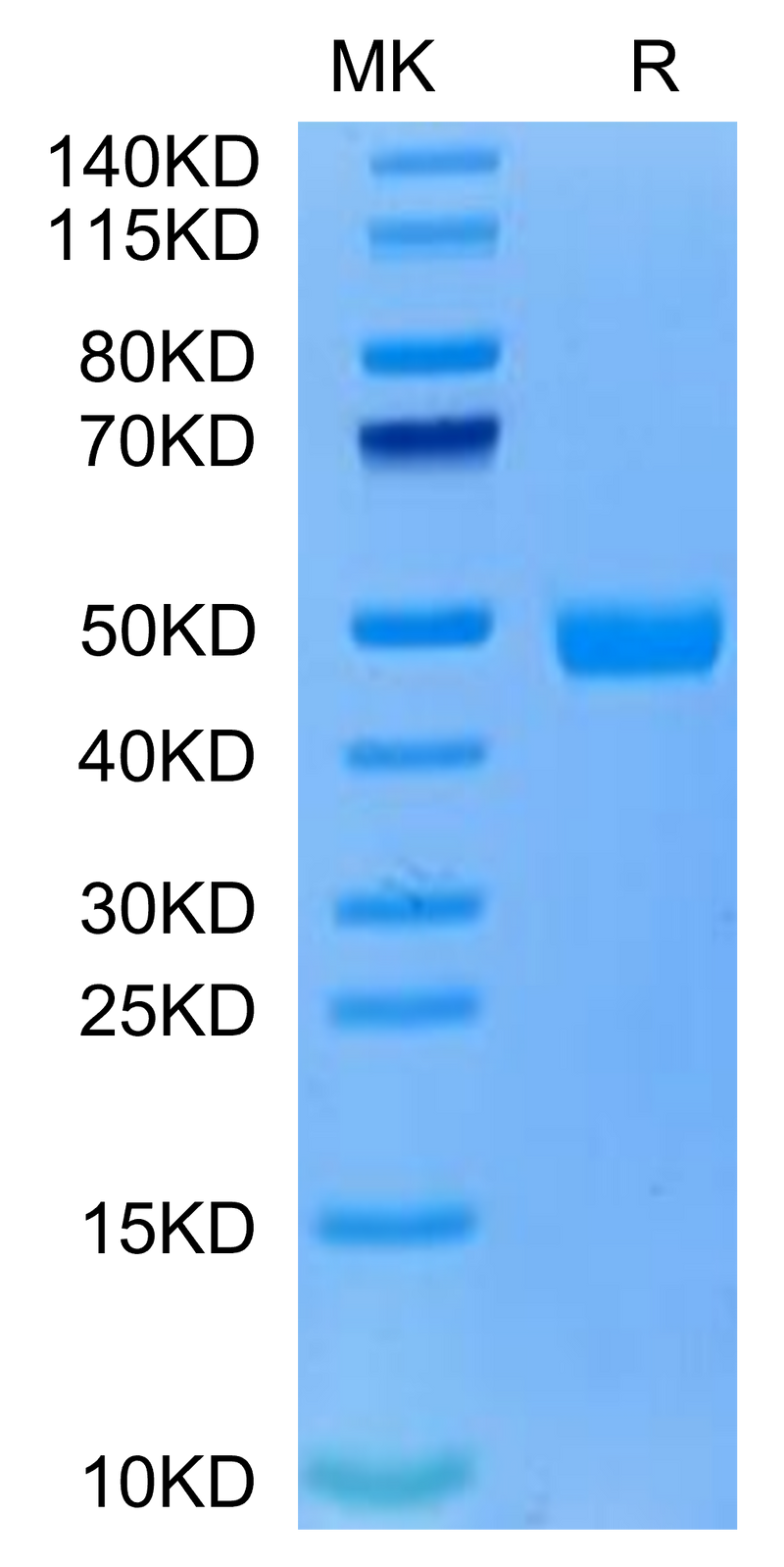 Cynomolgus CD300A on Tris-Bis PAGE under reduced condition. The purity is greater than 95%.Recombinant Cynomolgus CD300A Protein