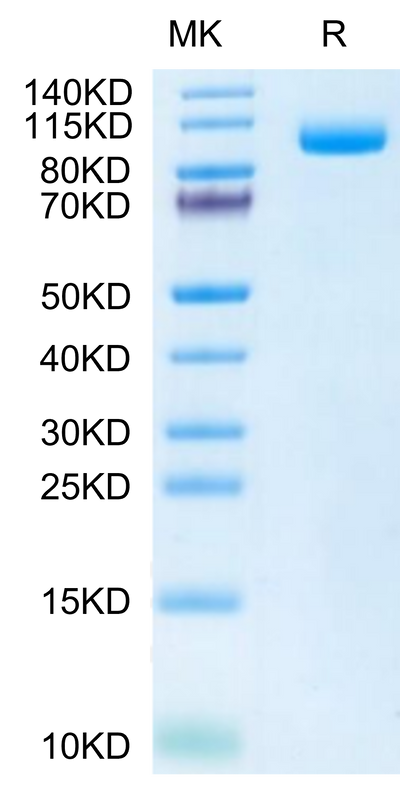 Biotinylated Mouse PSMA on Tris-Bis PAGE under reduced condition. The purity is greater than 95%.Biotinylated Mouse PSMA/FOLH1 Protein (Primary Amine Labeling)