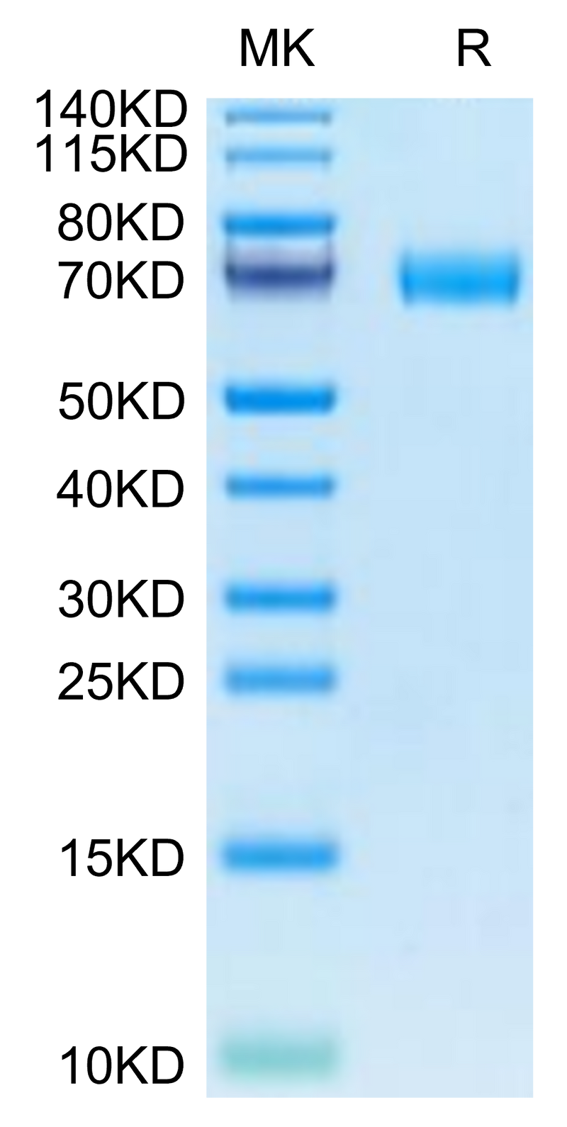 Canine MRC2 on Tris-Bis PAGE under reduced condition. The purity is greater than 95%.Recombinant Canine MRC2 Protein