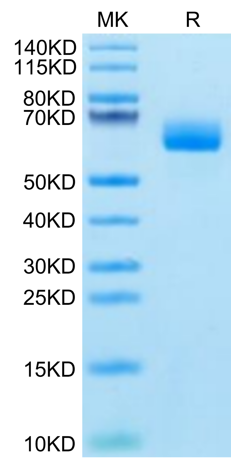 Cynomolgus SG3 on Tris-Bis PAGE under reduced condition. The purity is greater than 95%.Recombinant Cynomolgus SG3/Secretogranin 3 Protein, Active