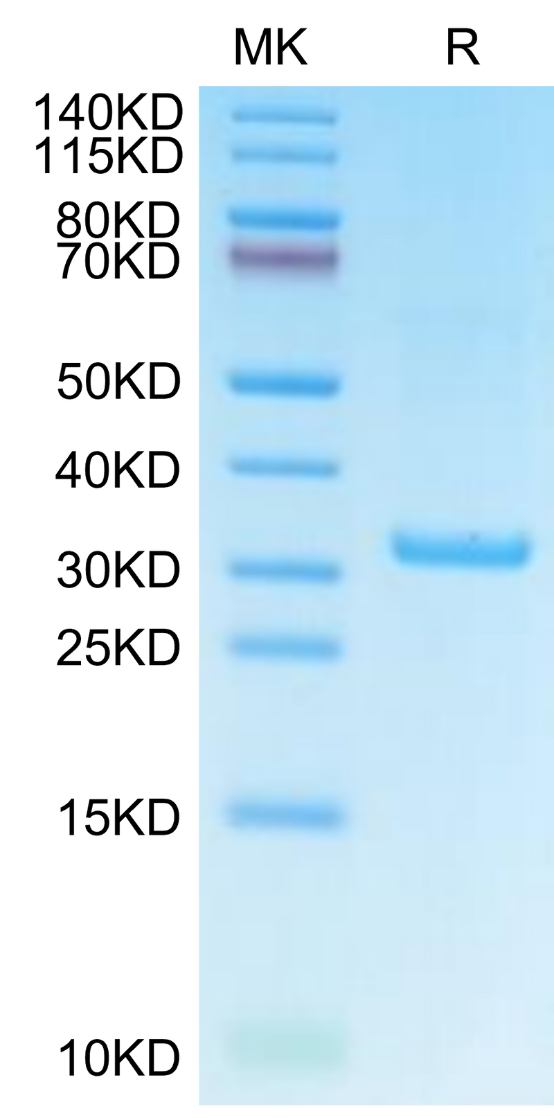 Human IgE on Tris-Bis PAGE under reduced condition. The purity is greater than 95%.Recombinant Human IgE Protein, Active