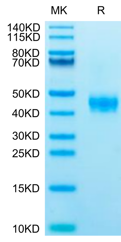 Human CCR8 on Tris-Bis PAGE under reduced condition. The purity is greater than 95%.Recombinant Human CCR8 Protein, Active