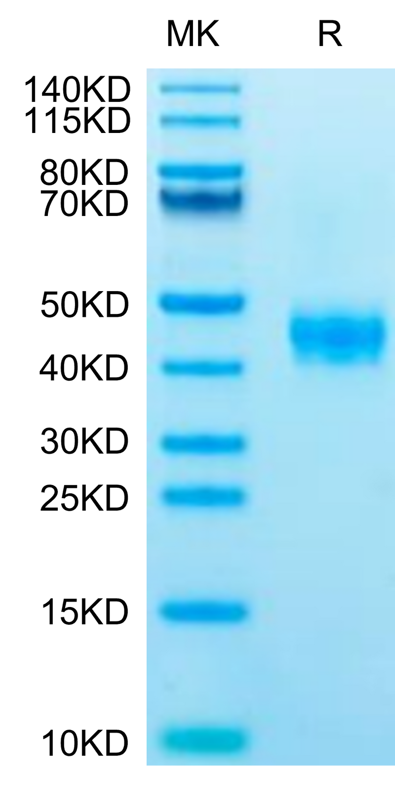 Human CCR8 on Tris-Bis PAGE under reduced condition. The purity is greater than 95%.Recombinant Human CCR8 Protein, Active