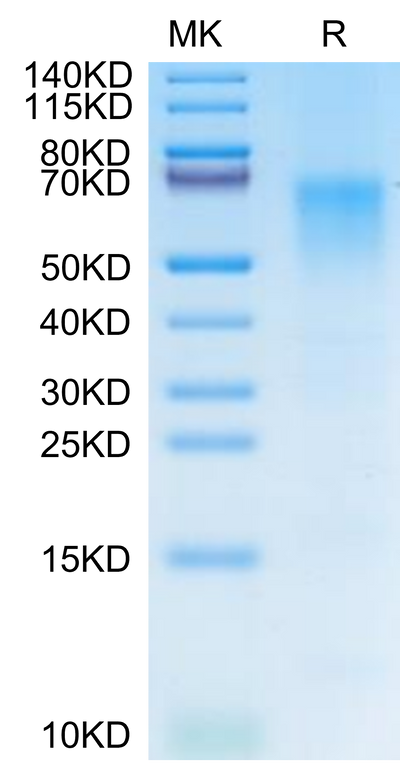 Cynomolgus/Rhesus macaque CD19 on Tris-Bis PAGE under reduced condition. The purity is greater than 95%.Recombinant Cynomolgus/Rhesus macaque CD19 Protein, Active