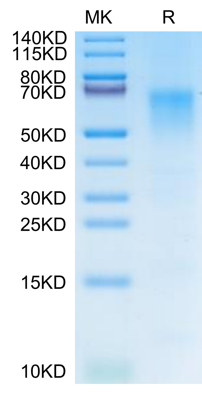 Cynomolgus/Rhesus macaque CD19 on Tris-Bis PAGE under reduced condition. The purity is greater than 95%.Recombinant Cynomolgus/Rhesus macaque CD19 Protein, Active