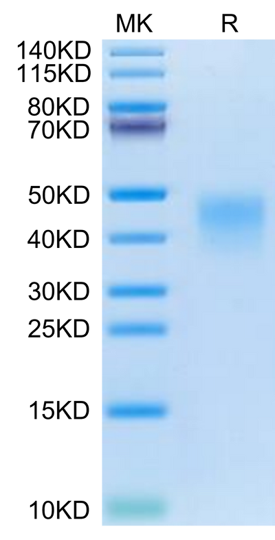 Cynomolgus PD-1 on Tris-Bis PAGE under reduced condition. The purity is greater than 95%.Recombinant Cynomolgus PD-1/PDCD1 Protein, Active