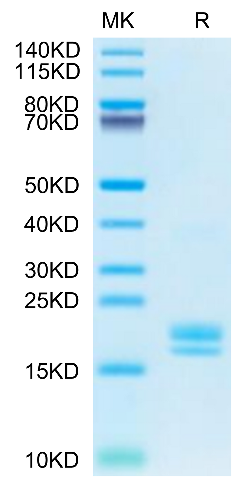 Cynomolgus TNF alpha on Tris-Bis PAGE under reduced condition. The purity is greater than 95%.Recombinant Cynomolgus TNF alpha Protein, Active