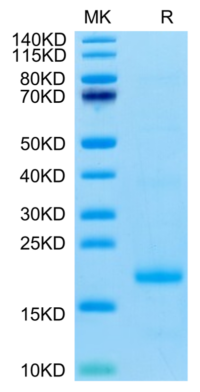 Cynomolgus IL-10 on Tris-Bis PAGE under reduced condition. The purity is greater than 95%.Recombinant Cynomolgus IL-10 Protein, Active
