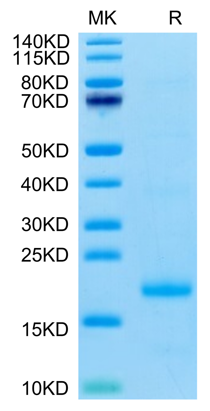 Cynomolgus IL-10 on Tris-Bis PAGE under reduced condition. The purity is greater than 95%.Recombinant Cynomolgus IL-10 Protein, Active