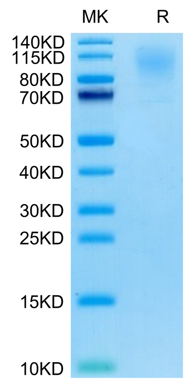 Cynomolgus CD43 on Tris-Bis PAGE under reduced condition. The purity is greater than 95%.Recombinant Cynomolgus CD43 Protein