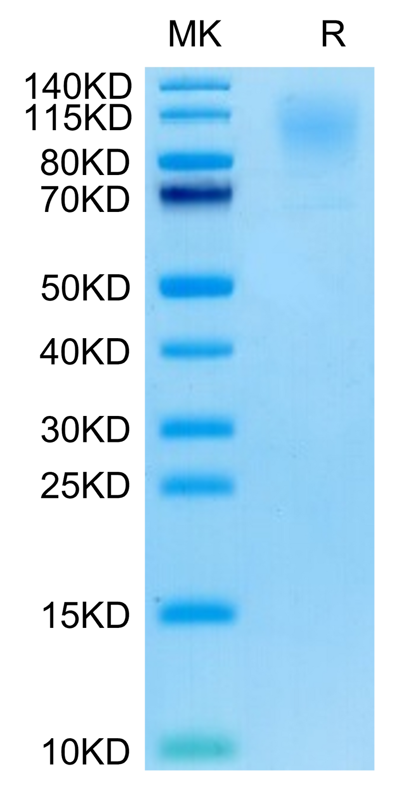 Cynomolgus CD43 on Tris-Bis PAGE under reduced condition. The purity is greater than 95%.Recombinant Cynomolgus CD43 Protein