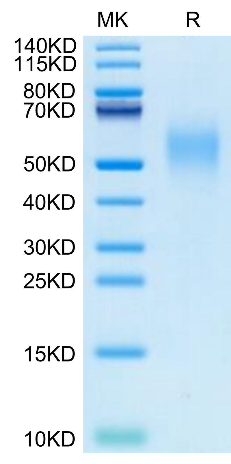 Cynomolgus Nectin-2 on Bis-Tris PAGE under reduced condition. The purity is greater than 95%.Recombinant Cynomolgus Nectin-2/CD112 Protein