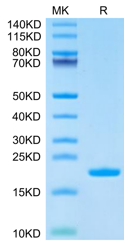 Cynomolgus IL-1 Beta on Tris-Bis PAGE under reduced condition. The purity is greater than 95%.Recombinant Cynomolgus IL-1 Beta/IL-1F2 Protein, Active